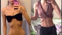 Azmin zaferi! Anoreksiya hastası kız imkansızı başardı…