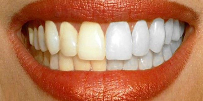 Doğal yollardan dişlerinizi beyazlatabilirsiniz