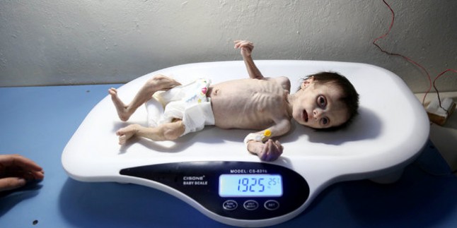 Açlıktan ölen Suriyeli bebeğin son anları kameraya yansıdı