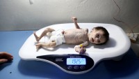 Açlıktan ölen Suriyeli bebeğin son anları kameraya yansıdı