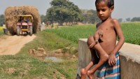 Hindistan’da 8 Kol Ve Bacağı Olan Çocuk Şaşırtıyor