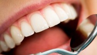 Kanal tedavili diş ağrı yapar mı?